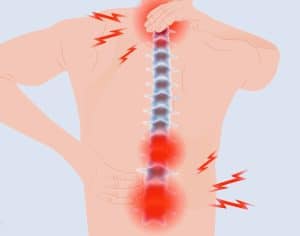 Soreness or tenderness in the spine. common referral sites of facet joint pain
