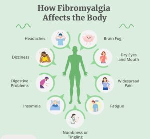 the various symptoms associated with fibromyalgia